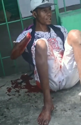 Man Got Hand Chopped Off & Left In The Street For Stealing