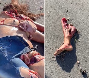 Young Girl Left Mangled and Fucked Up From Accident