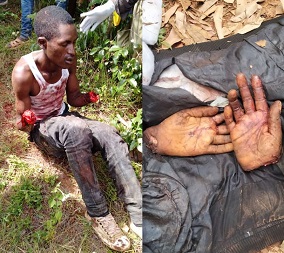 Self Defense Group Chops Hands off of Cattle Thief Leaves Him Alive as Warning