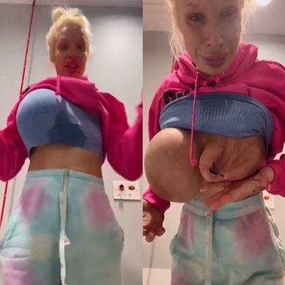 (Uncensored) OnlyFans UK Girl Has A Melt Down In The Hospital After Her Implant Exploded... Asking for Donations