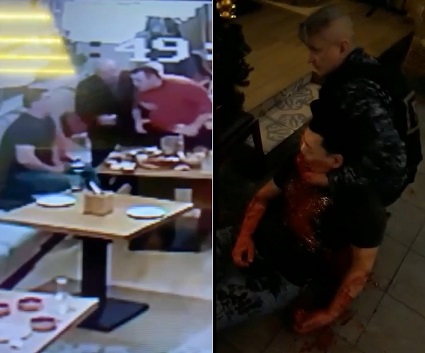 Man Stabbed In Violent Bar Fight Bleeds Like A Pig (Full Video)