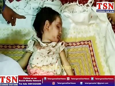 Shocking: Ameera 18 Months Old Baby Died On The Spot Hit