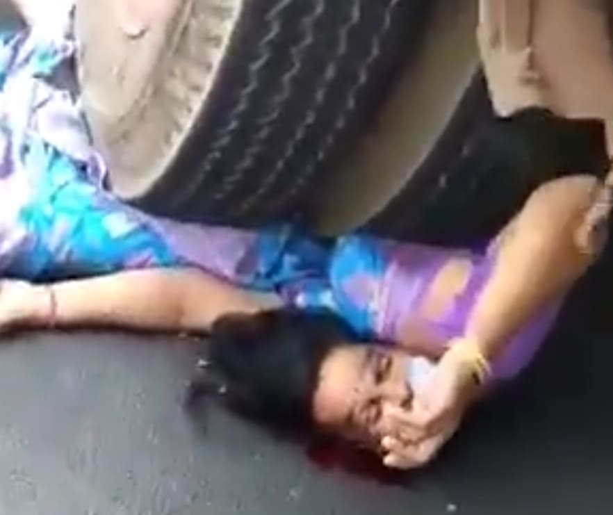 Woman Suffered Painful And Awkward Death