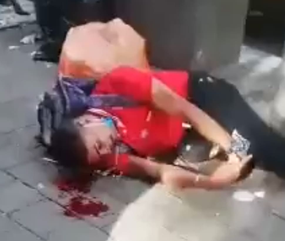 Alleged Phone Thief Received Machete Blow To The Head