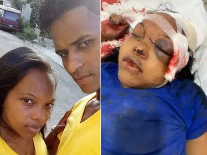 Young Woman Beaten By Ex And Left For Dead