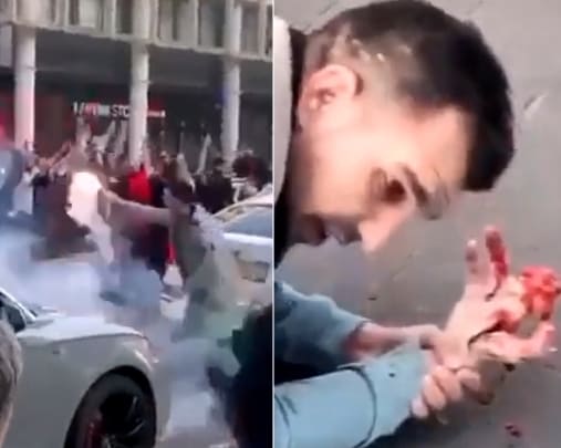 Guy Blows His Hand Up With Fireworks During Parade