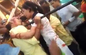 Girl Loses Part of Her Face While Trying to Take Selfie on Ferris Wheel (GRAPHIC)