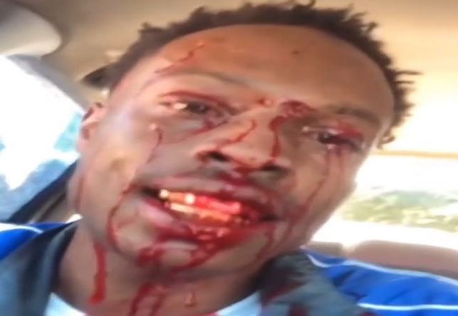 Man Goes on Facebook Live After Being Shot in the Face (GRAPHIC)