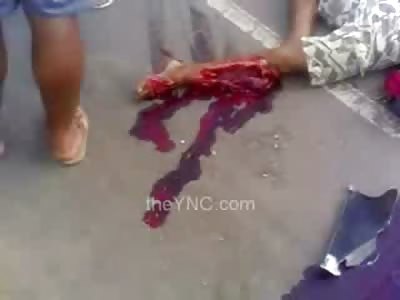 Man Decapitated from Horrific Accident... Pool Of Blood in Street
