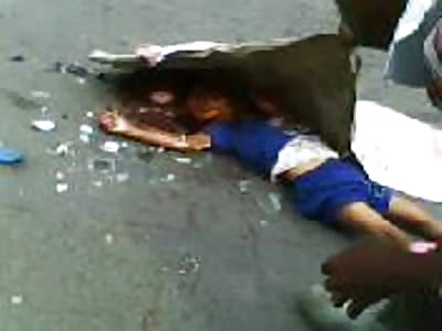 Woman s Leg Ripped to Shreds From Terrible Accident.... Her Daughter Lies Dead Next to Her