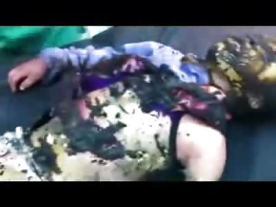 Horrific Video of Kids...KIDS that were Burned Alive....One Dead Already, One still Alive