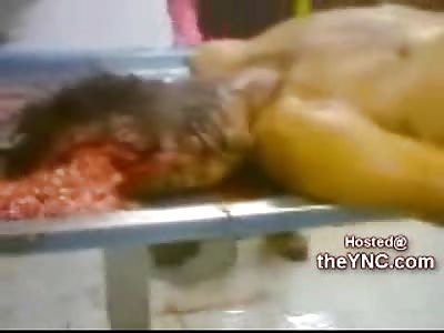 Brains all Over the Table in the Morgue are Attempted to Put back into Skull (Video is Graphic)