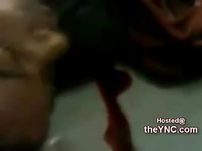 Bumba Clot ! Dead Jamaican in the Morgue had Head Blown Open