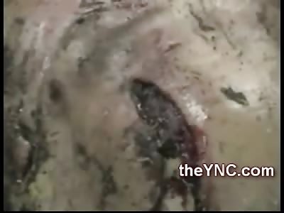 Clean your Ears: Old Man with Maggots festering inside of his Ears