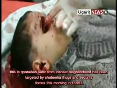 9 Year Old Boy Head Shot by Sniper, Exit Wound in the Back of Head