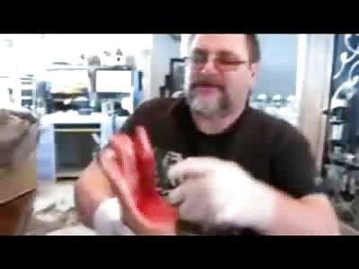 Man on too many Vicodin shows off his Severed, still Bleeding Foot