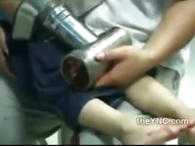 GREAT PARENTING: Poor Little Kids Arm Ripped off by Meat Grinder