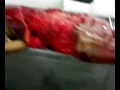 Woman Dragged to Death during Motorcycle Accident has Ass Ripped Off (Graphic Video)