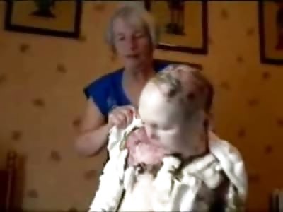 Bizarre Video of a Poor Boy who is Losing his Skin...(No Audio)
