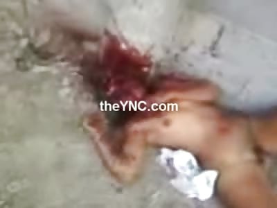 SHOCK Video: Fully Nude Female Head Caved In from Beating to the Face....(YNC Classic) 