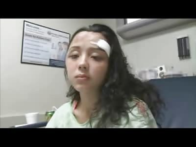 Teenage Mom in her Hospital Room shows off her Bashed up Head and Bruises from her Asshole Boyfriend